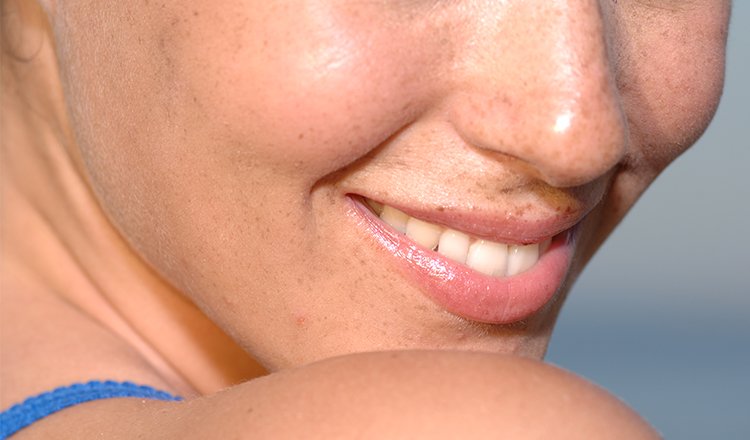 Dr Peter Marinovic: How Poor Oral Health Can Affect Your Overall Health