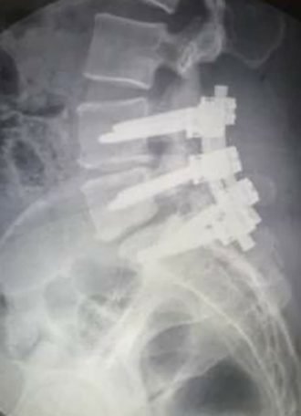 x-ray, trauma